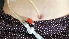 Female Valve