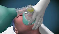 Medical Check Valve