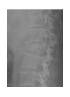 Screws