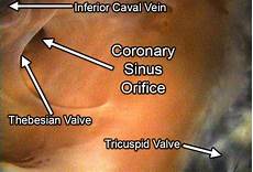 Septum Valve
