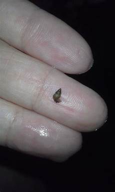 Snails