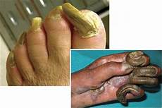 Twisted Nails
