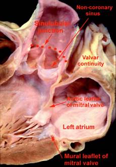 Valve Part